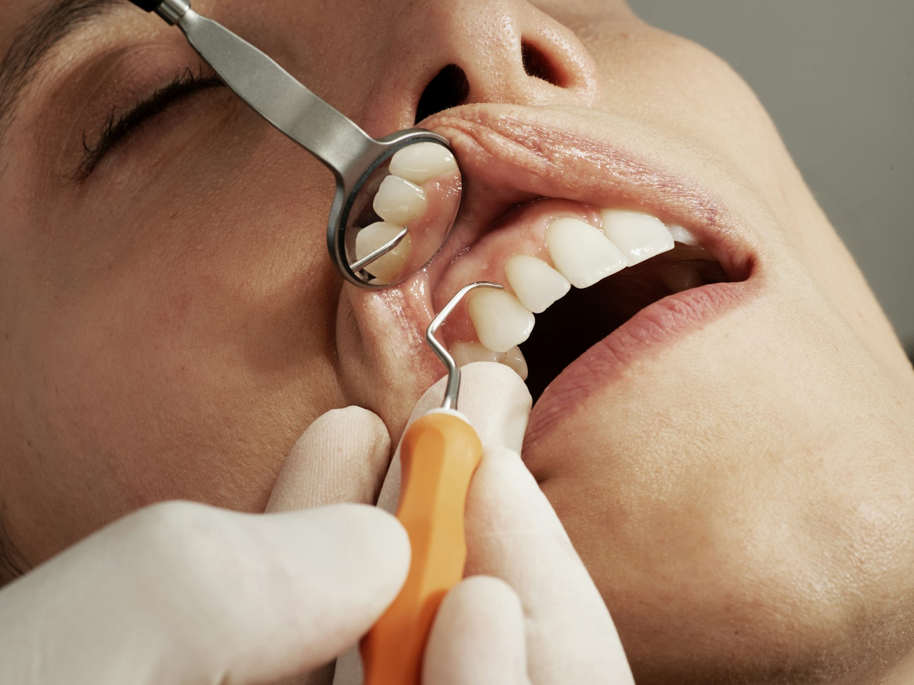 Immagine dimostrativa, non una fotografia dello Studio Nicolodi: igiene dentale